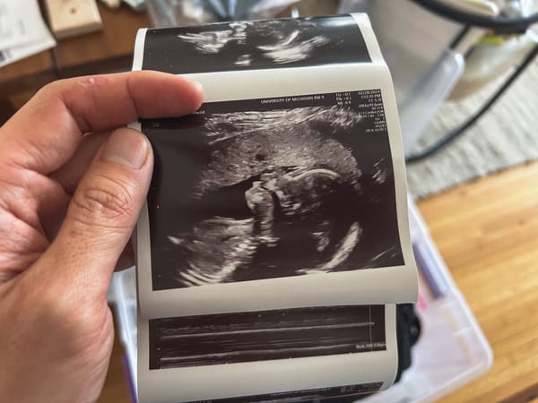 Hand holding ultrasound photo with side profile of Baby’s head